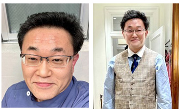 腫れが取れてカユミもなくなりましたが、まだ少し肌色がクスんでいます。